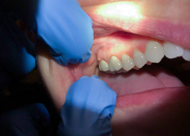 Best Broken or Cracked Tooth Emergency Dentist in Tsaile, AZ